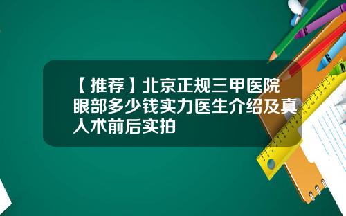 【推荐】北京正规三甲医院眼部多少钱实力医生介绍及真人术前后实拍