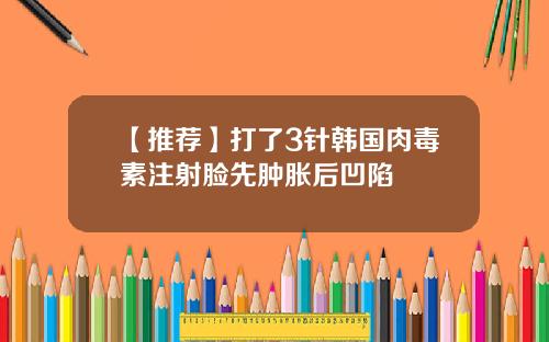 【推荐】打了3针韩国肉毒素注射脸先肿胀后凹陷