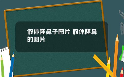 假体隆鼻子图片 假体隆鼻的图片