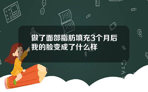 做了面部脂肪填充3个月后我的脸变成了什么样