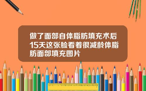 做了面部自体脂肪填充术后15天这张脸看着很减龄体脂肪面部填充图片