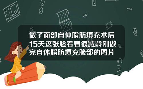 做了面部自体脂肪填充术后15天这张脸看着很减龄刚做完自体脂肪填充脸部的图片