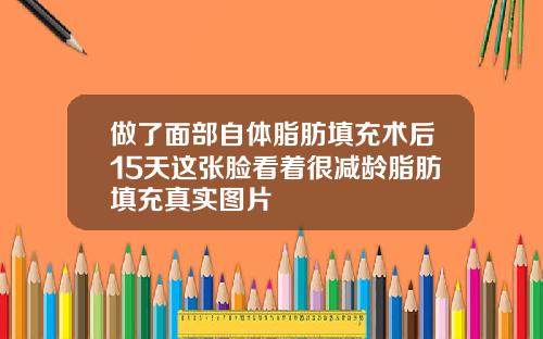 做了面部自体脂肪填充术后15天这张脸看着很减龄脂肪填充真实图片