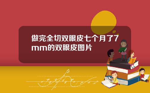做完全切双眼皮七个月了7mm的双眼皮图片