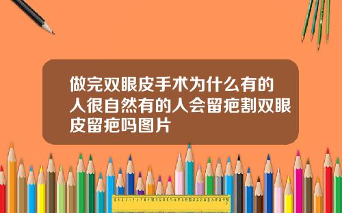 做完双眼皮手术为什么有的人很自然有的人会留疤割双眼皮留疤吗图片