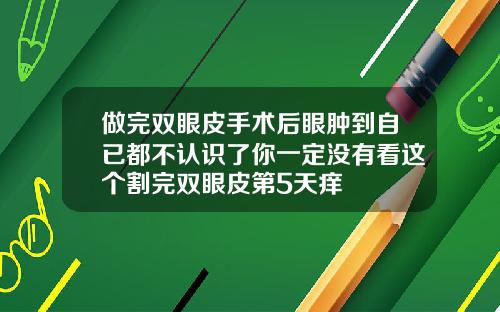 做完双眼皮手术后眼肿到自已都不认识了你一定没有看这个割完双眼皮第5天痒