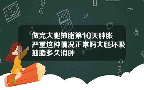 做完大腿抽脂第10天肿胀严重这种情况正常吗大腿环吸抽脂多久消肿