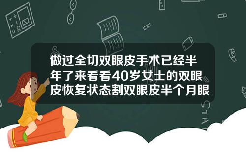 做过全切双眼皮手术已经半年了来看看40岁女士的双眼皮恢复状态割双眼皮半个月眼睛往上看还有拉扯