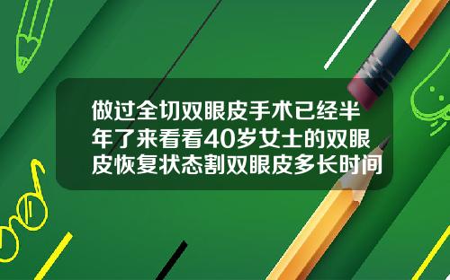 做过全切双眼皮手术已经半年了来看看40岁女士的双眼皮恢复状态割双眼皮多长时间能恢复正常好看呢
