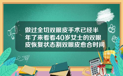 做过全切双眼皮手术已经半年了来看看40岁女士的双眼皮恢复状态割双眼皮愈合时间多久
