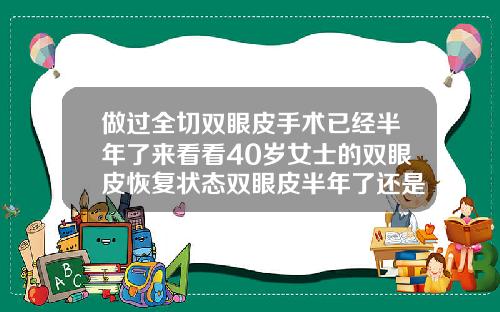 做过全切双眼皮手术已经半年了来看看40岁女士的双眼皮恢复状态双眼皮半年了还是肿的怎么办