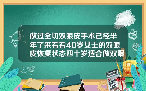 做过全切双眼皮手术已经半年了来看看40岁女士的双眼皮恢复状态四十岁适合做双眼皮手术吗
