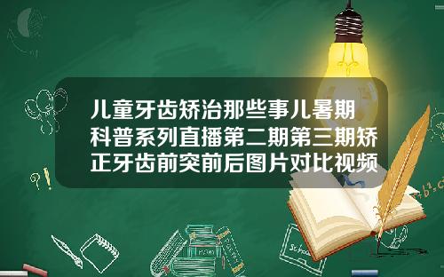 儿童牙齿矫治那些事儿暑期科普系列直播第二期第三期矫正牙齿前突前后图片对比视频