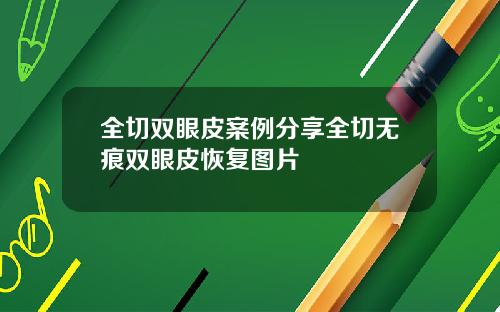 全切双眼皮案例分享全切无痕双眼皮恢复图片