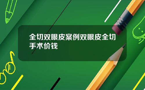 全切双眼皮案例双眼皮全切手术价钱