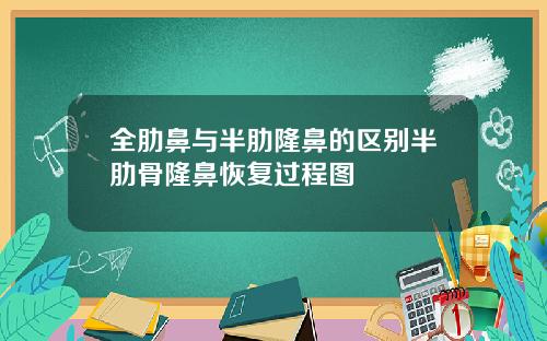 全肋鼻与半肋隆鼻的区别半肋骨隆鼻恢复过程图
