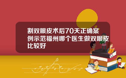 割双眼皮术后70天正确案例示范福州哪个医生做双眼皮比较好