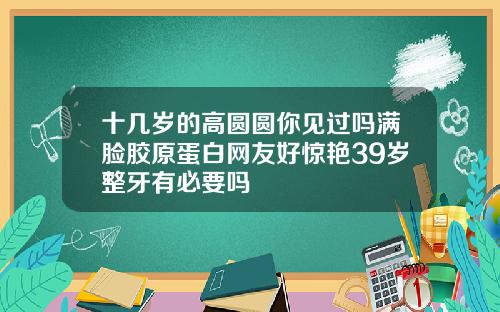 十几岁的高圆圆你见过吗满脸胶原蛋白网友好惊艳39岁整牙有必要吗
