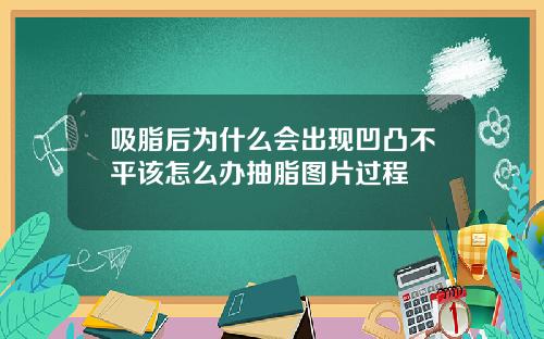 吸脂后为什么会出现凹凸不平该怎么办抽脂图片过程