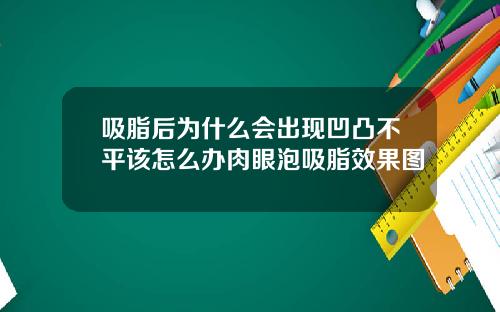 吸脂后为什么会出现凹凸不平该怎么办肉眼泡吸脂效果图