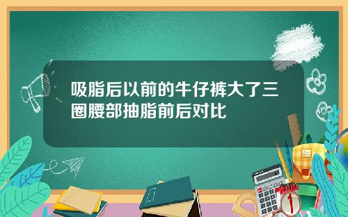 吸脂后以前的牛仔裤大了三圈腰部抽脂前后对比