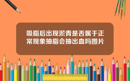 吸脂后出现淤青是否属于正常现象抽脂会抽出血吗图片