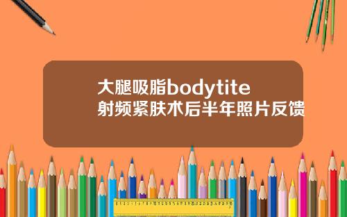 大腿吸脂bodytite射频紧肤术后半年照片反馈