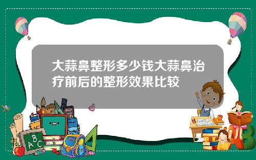 大蒜鼻整形多少钱大蒜鼻治疗前后的整形效果比较