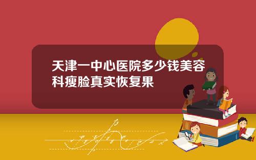 天津一中心医院多少钱美容科瘦脸真实恢复果