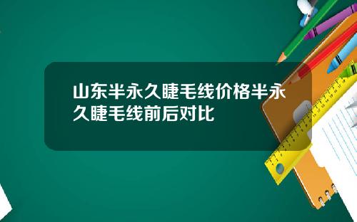 山东半永久睫毛线价格半永久睫毛线前后对比