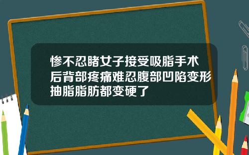 惨不忍睹女子接受吸脂手术后背部疼痛难忍腹部凹陷变形抽脂脂肪都变硬了