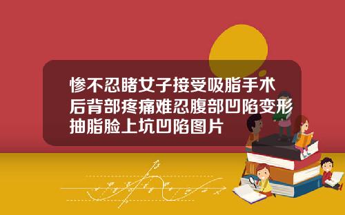 惨不忍睹女子接受吸脂手术后背部疼痛难忍腹部凹陷变形抽脂脸上坑凹陷图片