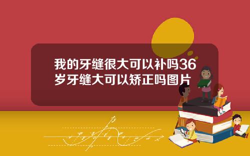 我的牙缝很大可以补吗36岁牙缝大可以矫正吗图片