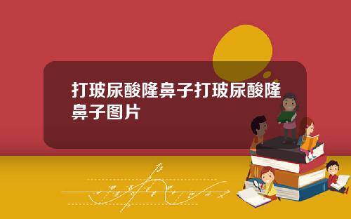打玻尿酸隆鼻子打玻尿酸隆鼻子图片