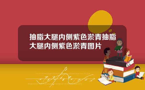 抽脂大腿内侧紫色淤青抽脂大腿内侧紫色淤青图片