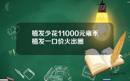 植发少花11000元雍禾植发一口价火出圈