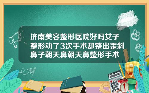 济南美容整形医院好吗女子整形动了3次手术却整出歪斜鼻子朝天鼻朝天鼻整形手术