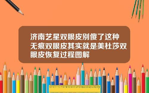 济南艺星双眼皮别傻了这种无痕双眼皮其实就是美杜莎双眼皮恢复过程图解