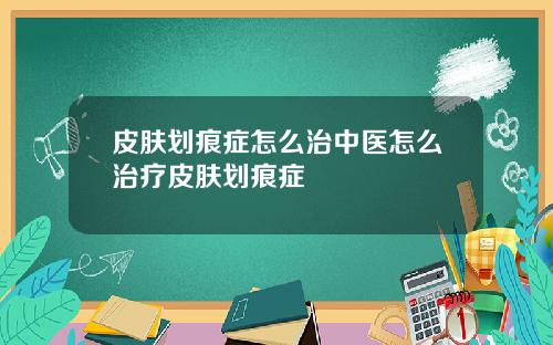 皮肤划痕症怎么治中医怎么治疗皮肤划痕症
