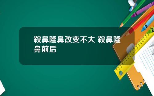 鞍鼻隆鼻改变不大 鞍鼻隆鼻前后