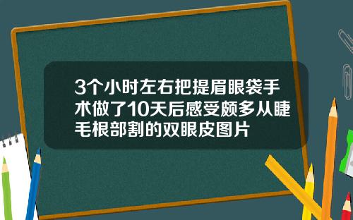 3个小时左右把提眉眼袋手术做了10天后感受颇多从睫毛根部割的双眼皮图片