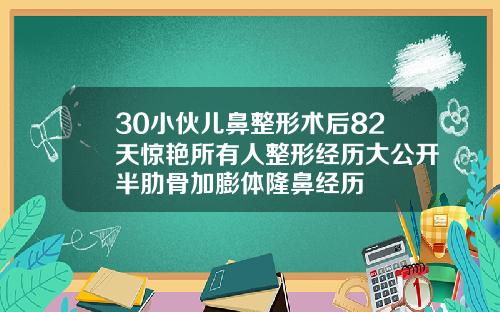 30小伙儿鼻整形术后82天惊艳所有人整形经历大公开半肋骨加膨体隆鼻经历