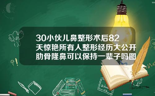 30小伙儿鼻整形术后82天惊艳所有人整形经历大公开肋骨隆鼻可以保持一辈子吗图片