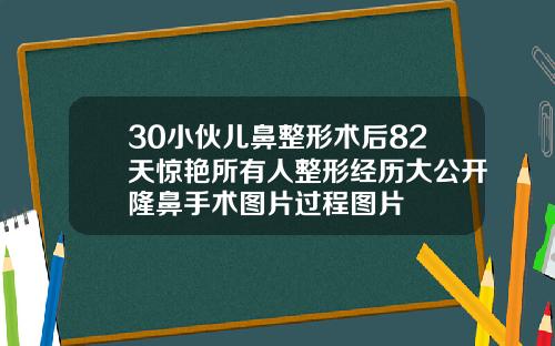 30小伙儿鼻整形术后82天惊艳所有人整形经历大公开隆鼻手术图片过程图片