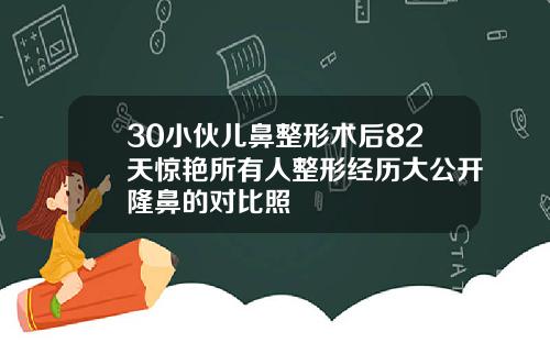 30小伙儿鼻整形术后82天惊艳所有人整形经历大公开隆鼻的对比照