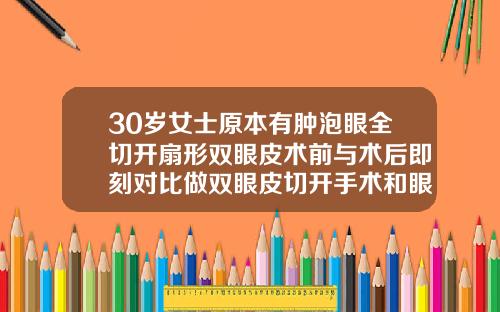 30岁女士原本有肿泡眼全切开扇形双眼皮术前与术后即刻对比做双眼皮切开手术和眼综合手术哪个术后恢复时间更久