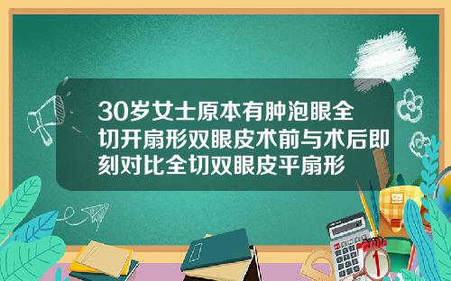 30岁女士原本有肿泡眼全切开扇形双眼皮术前与术后即刻对比全切双眼皮平扇形