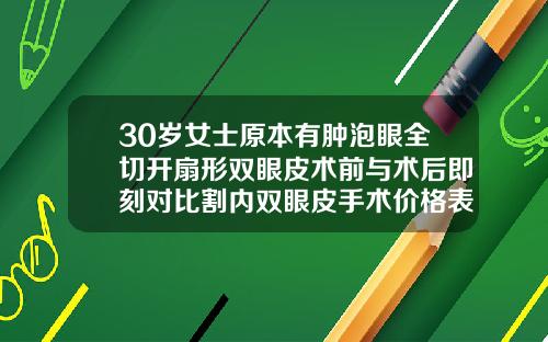 30岁女士原本有肿泡眼全切开扇形双眼皮术前与术后即刻对比割内双眼皮手术价格表