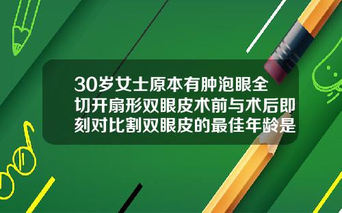 30岁女士原本有肿泡眼全切开扇形双眼皮术前与术后即刻对比割双眼皮的最佳年龄是多少岁了图片