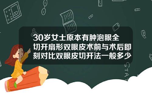 30岁女士原本有肿泡眼全切开扇形双眼皮术前与术后即刻对比双眼皮切开法一般多少钱